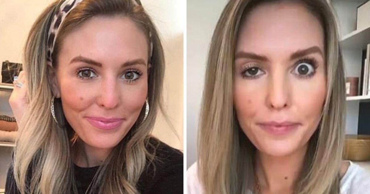 untitled design 58.jpg?resize=412,232 - Woman Left Looking Like A Supervillain After Botched Cosmetic Procedure