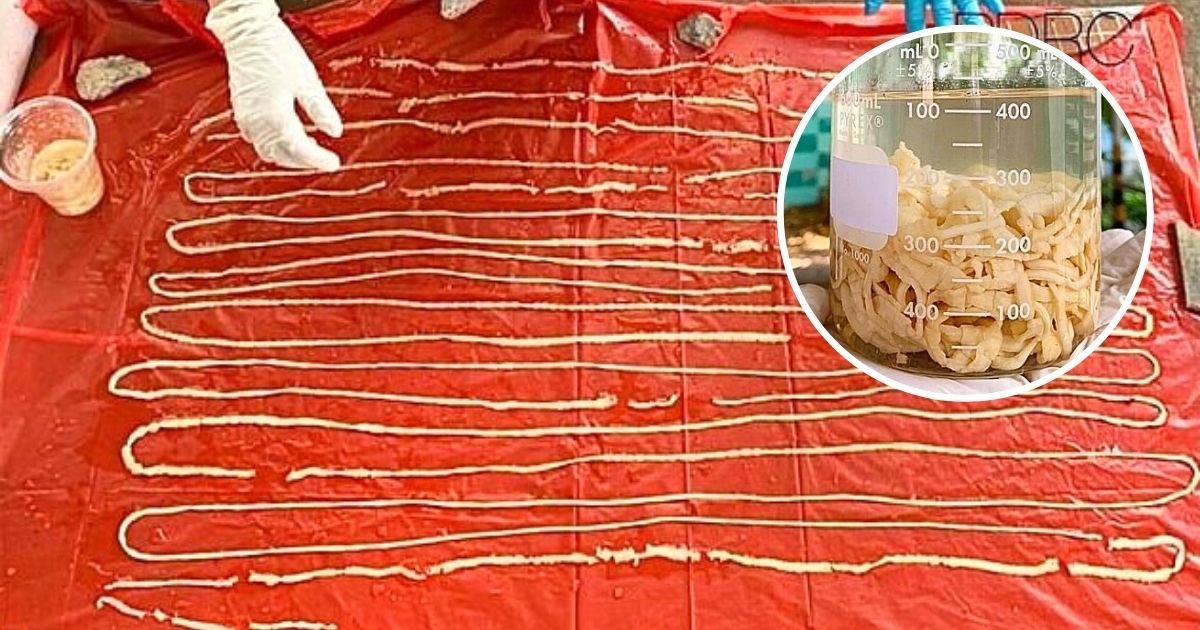 59 Foot Tapeworm Comes Out Of Mans Bottom After He Visited A Doctor For Flatulence Small Joys