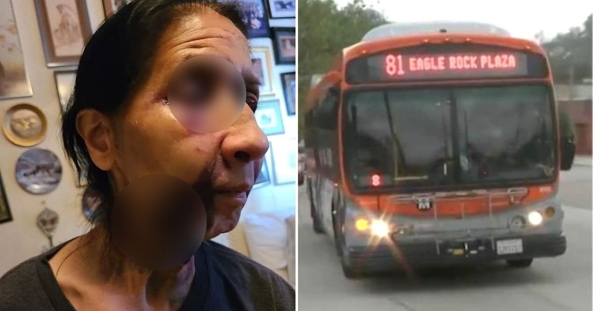 becky5.jpg?resize=412,232 - 70-Year-Old Woman Battered On Bus After A 23-Year-Old Passenger Thought She Was An Asian-American, Victim's Son Said