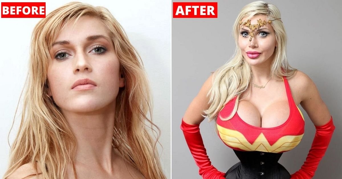 before.jpg?resize=412,275 - Woman Removes SIX Ribs And Insists This Is The ‘Ideal’ Female Body
