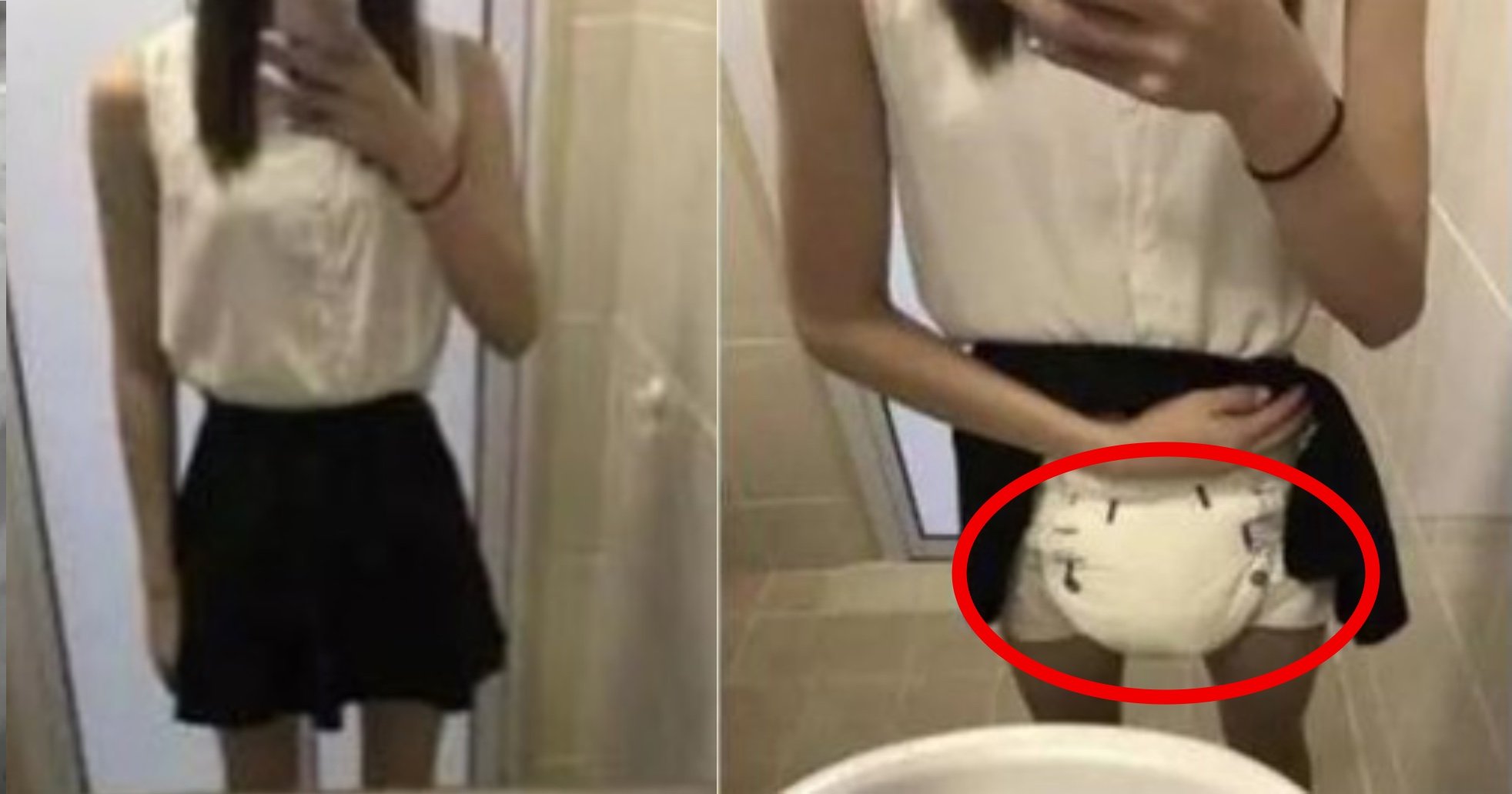 diaper.jpg?resize=412,232 - 19-Year-Old Girl Who Has To Wear A Diaper Every Day Shares Her Story Of Regret