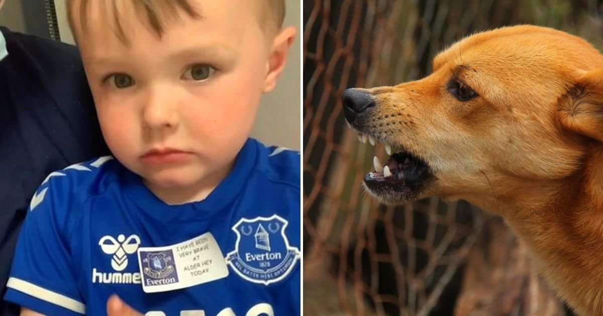luca4.jpg?resize=412,232 - Dog Mauls 3-Year-Old Boy In Playground And Leaves The Child With 'Flesh Hanging Off His Arm' And Teeth Marks