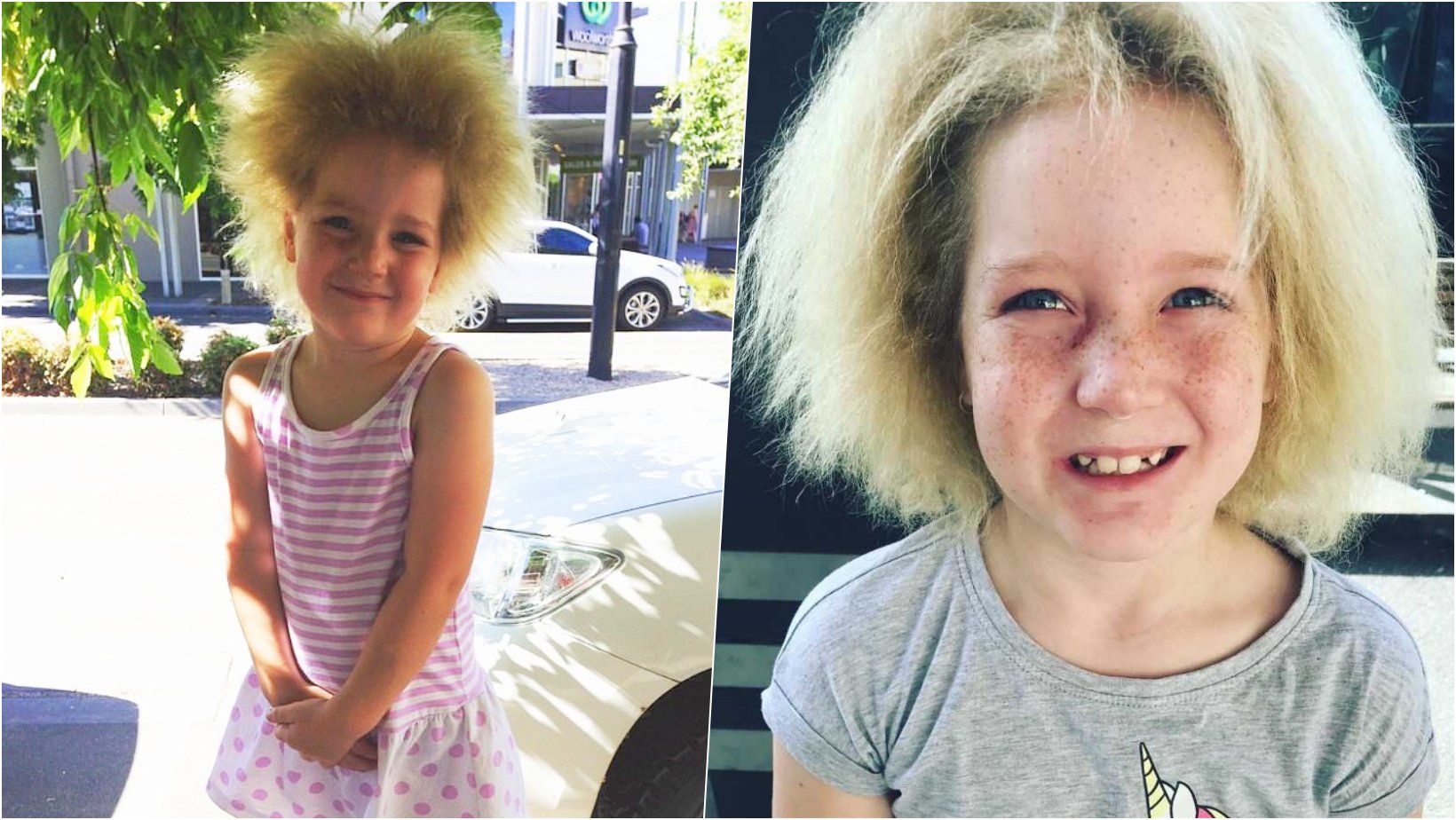 6 facebook cover 21.png?resize=412,232 - Girl With Rare Hair Syndrome Finally Embraces Fuzzy Hair And Resist Bullies