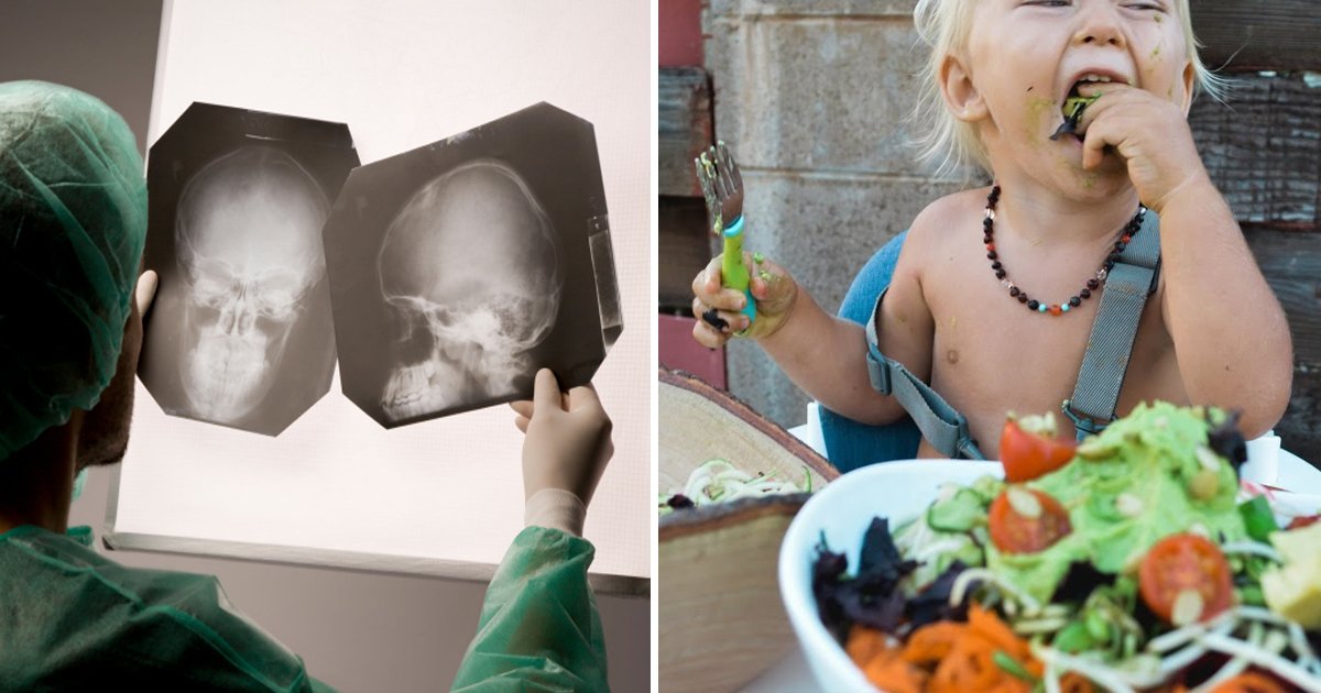 agagaaaa.jpg?fit=1024%2C538&ssl=1&strip=all - Baby Suffers Permanent Brain Damage After Parents Placed Her On An 'Extreme' Vegan Diet