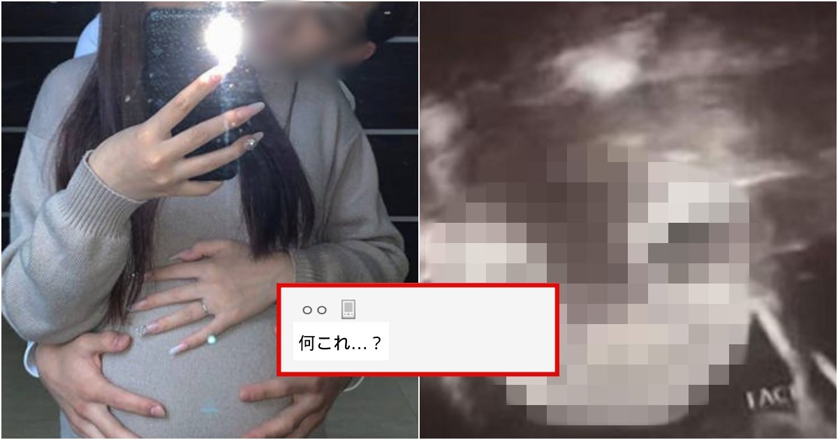 baby.png?resize=412,232 - (写真あり）「わ！これはないでしょう！」 「妊婦」と悲鳴を上げる「お腹の赤ちゃん」の鳥肌が立つ超音波写真