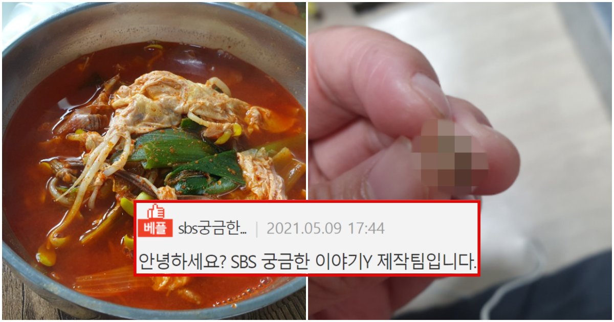 collage 108.png?resize=412,275 - “인천 중국집에서 음식 시켜먹었는데 사람 이빨이 나왔습니다… 그런데 중국집 사장님이 말하는 게 더 어이가 없네요” (+사진)