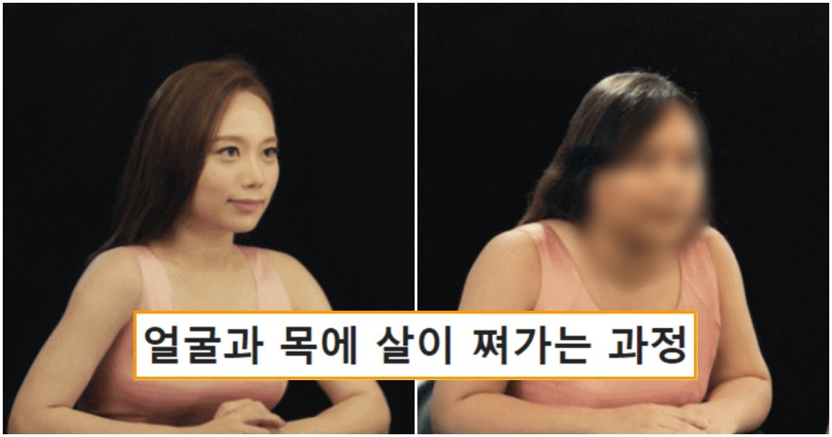 collage 19.jpg?fit=1024%2C538&ssl=1&strip=all - 체중이 늘면 변해가는 사람의 얼굴과 목의 변화