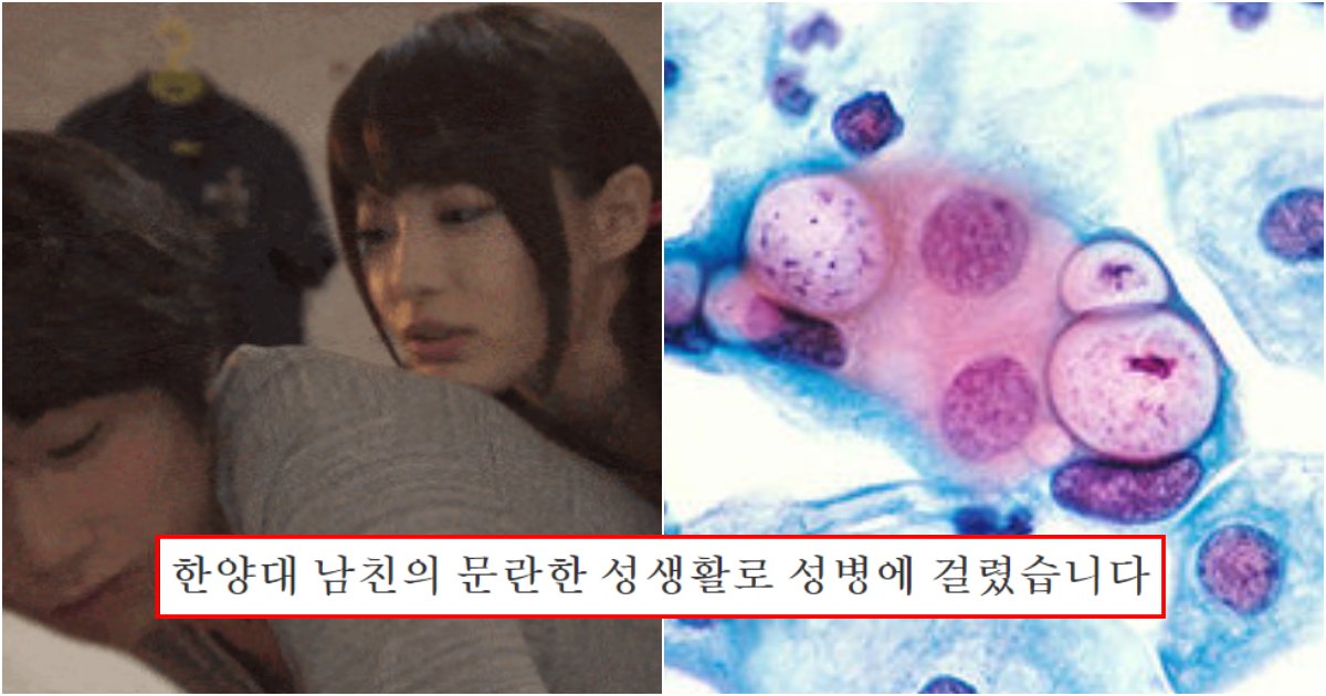 collage 472.png?resize=412,275 - "한양대 남친이랑 사귀는데 걔 때문에 성병에 걸렸습니다.. 고소 가능한가요"