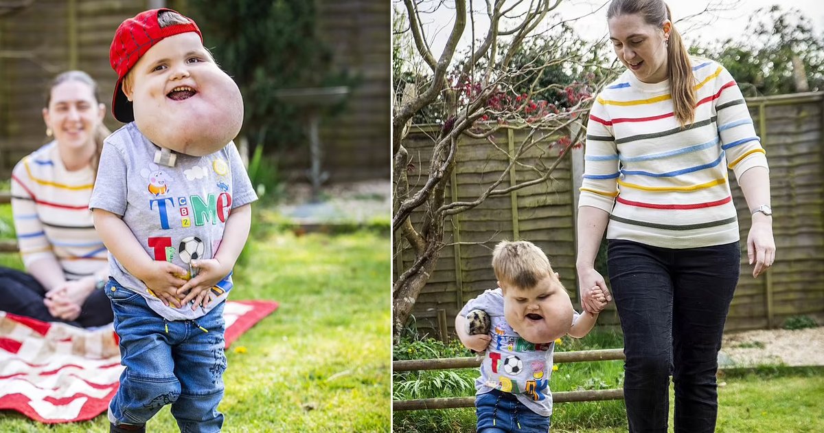 t8 14.jpg?resize=412,232 - Brave 4-Year-Old Boy Walks For The First Time Despite Giant Facial Cysts Defying His Odds To Take Steps