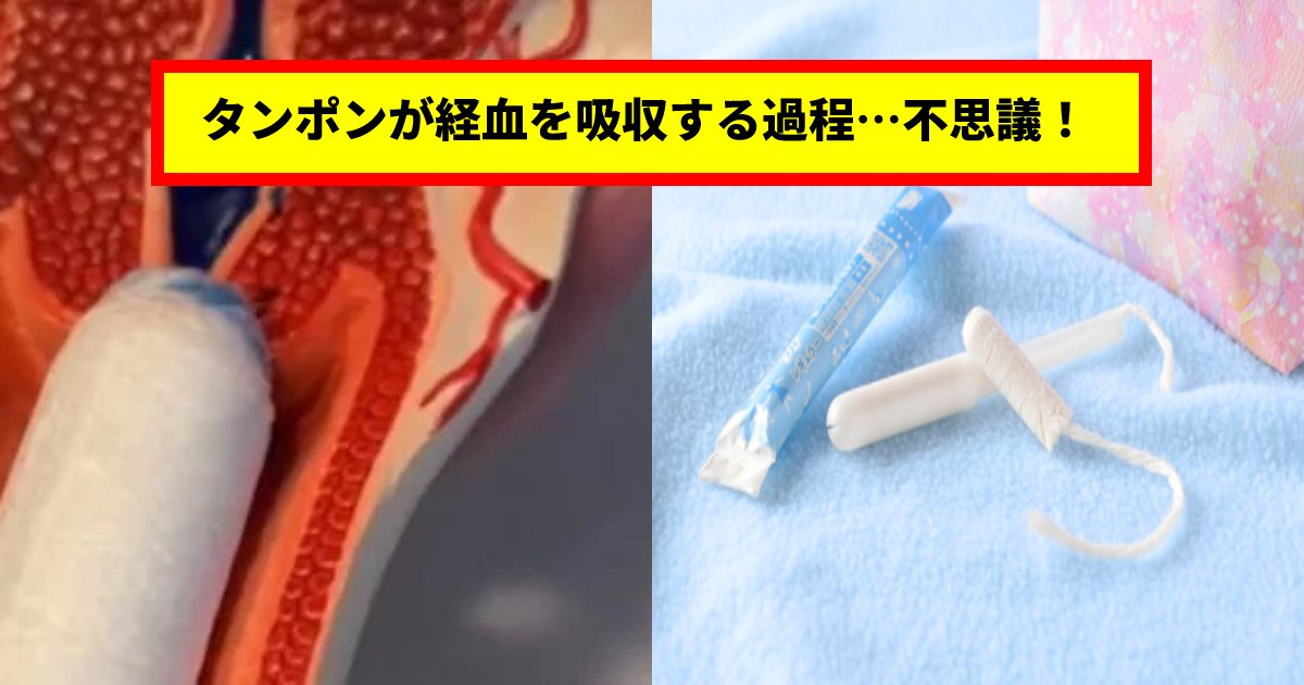 tampon.png?resize=1200,630 - 「膣にタンポンを挿入するとこうなる」タンポンが膣の中で経血を吸収する過程（映像）