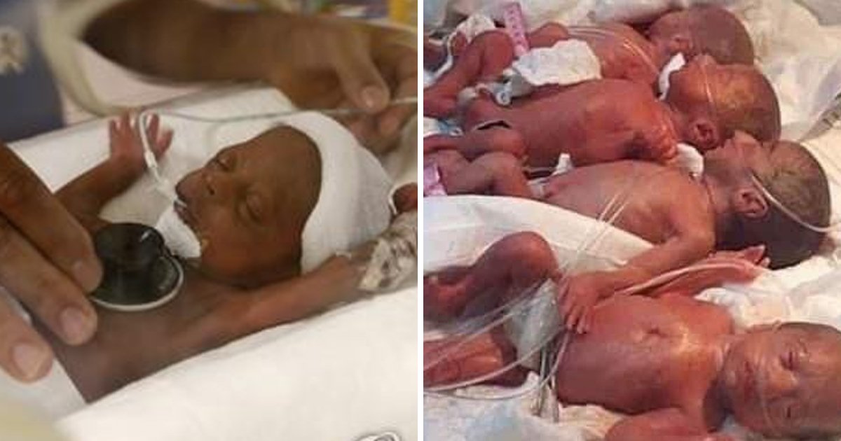 4 51.jpg?resize=1200,630 - 남아공, 37세 여성 세계 최초 열쌍둥이 출산