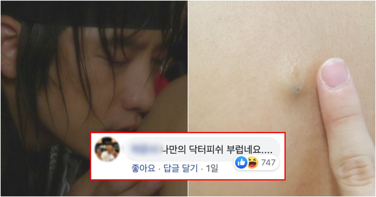 collage 10.png?resize=412,275 - "남친이 어깨에 난 '왕블랙헤드' 빨아먹었어요.." '야스'하다가 블랙헤드 입으로 압출해준 우송대 남친의 최후