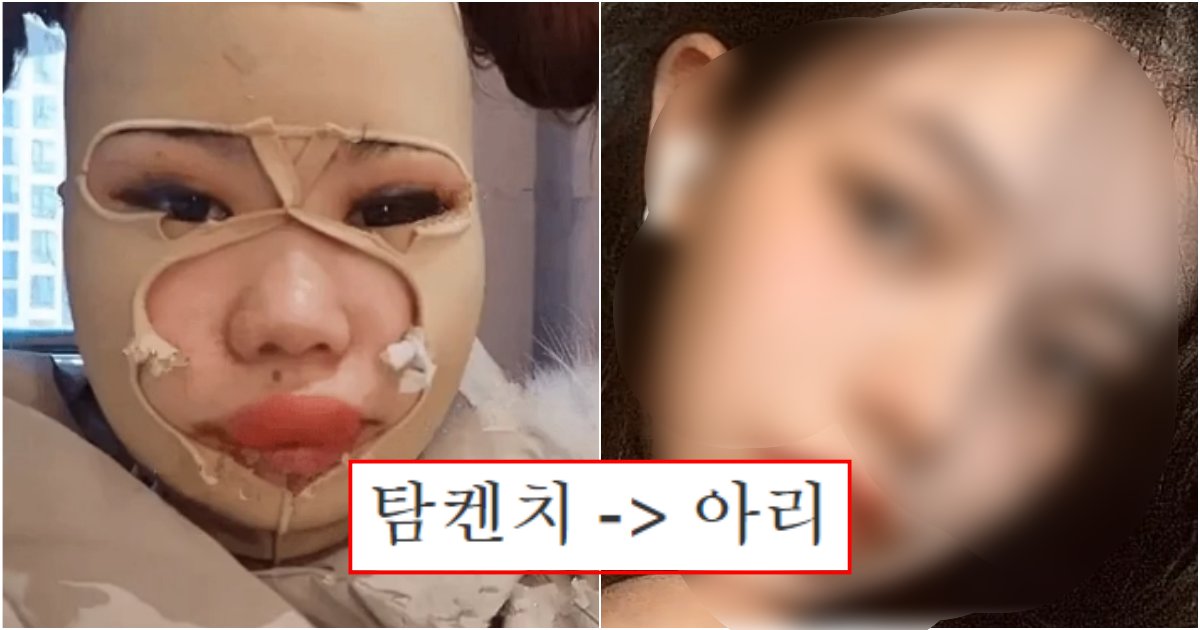 collage 41.png?resize=412,275 - 아무리봐도 도저히 안 믿기는 다시 태어났다며 난리 난 성형 전 후