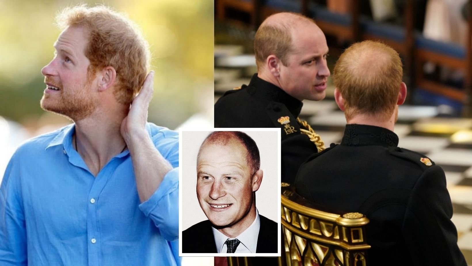 cover 12.jpg?resize=412,275 - Prince Harry’s Hair Loss Is Getting Worse Since He Moved To The US, Cosmetic Doctor Claims He Will Be Completely Bald At 50