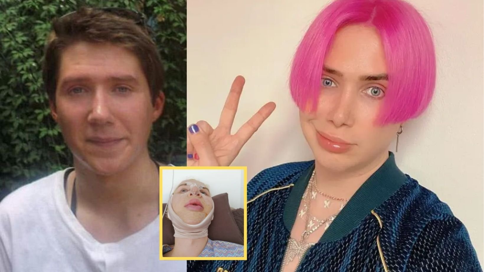 cover 22.jpg?fit=1024%2C577&ssl=1&strip=all - British Influencer Faced Heavy Backlash For Having Multiple Surgeries & Identifying Them As Korean