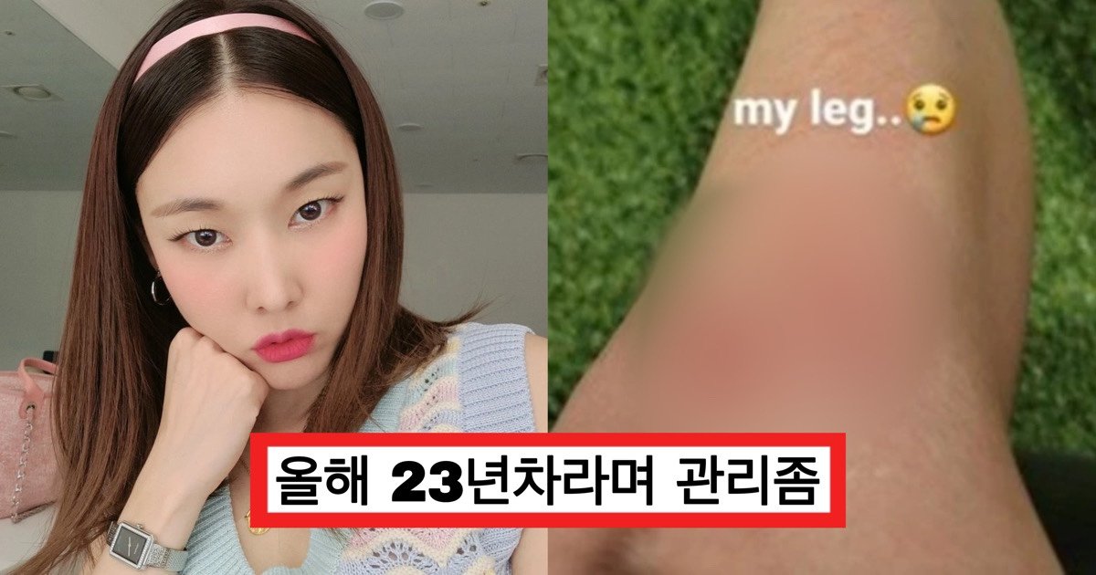 e3858ee3858ee38588.jpg?resize=412,275 - "몸이 자산인 23년차 모델 한혜진", 걱정 쏟아지고 있는 다리 상태 (+사진)