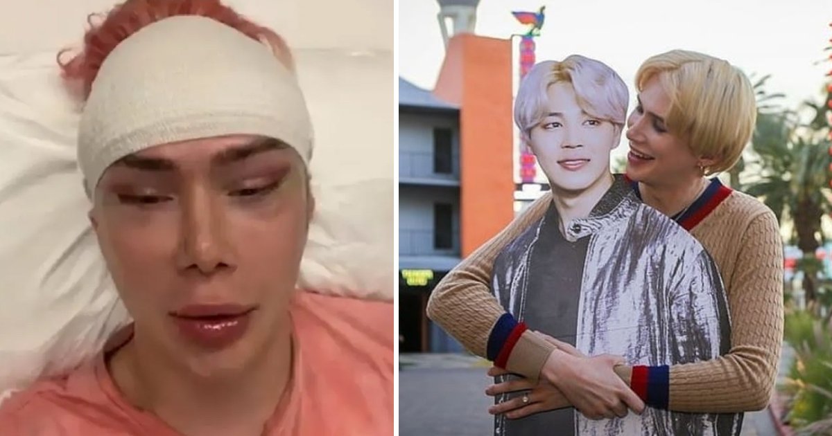 q1 25.jpg?resize=412,275 - Transracial Influencer Undergoes '18 Cosmetic Surgeries' To Look Like Popular BTS Singer