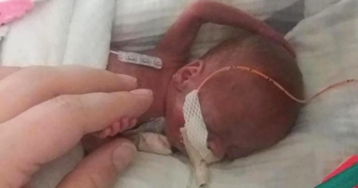 richard5.jpg?resize=412,232 - The World's Most Premature Baby Celebrates First Birthday After ZERO Percent Chance Of Survival