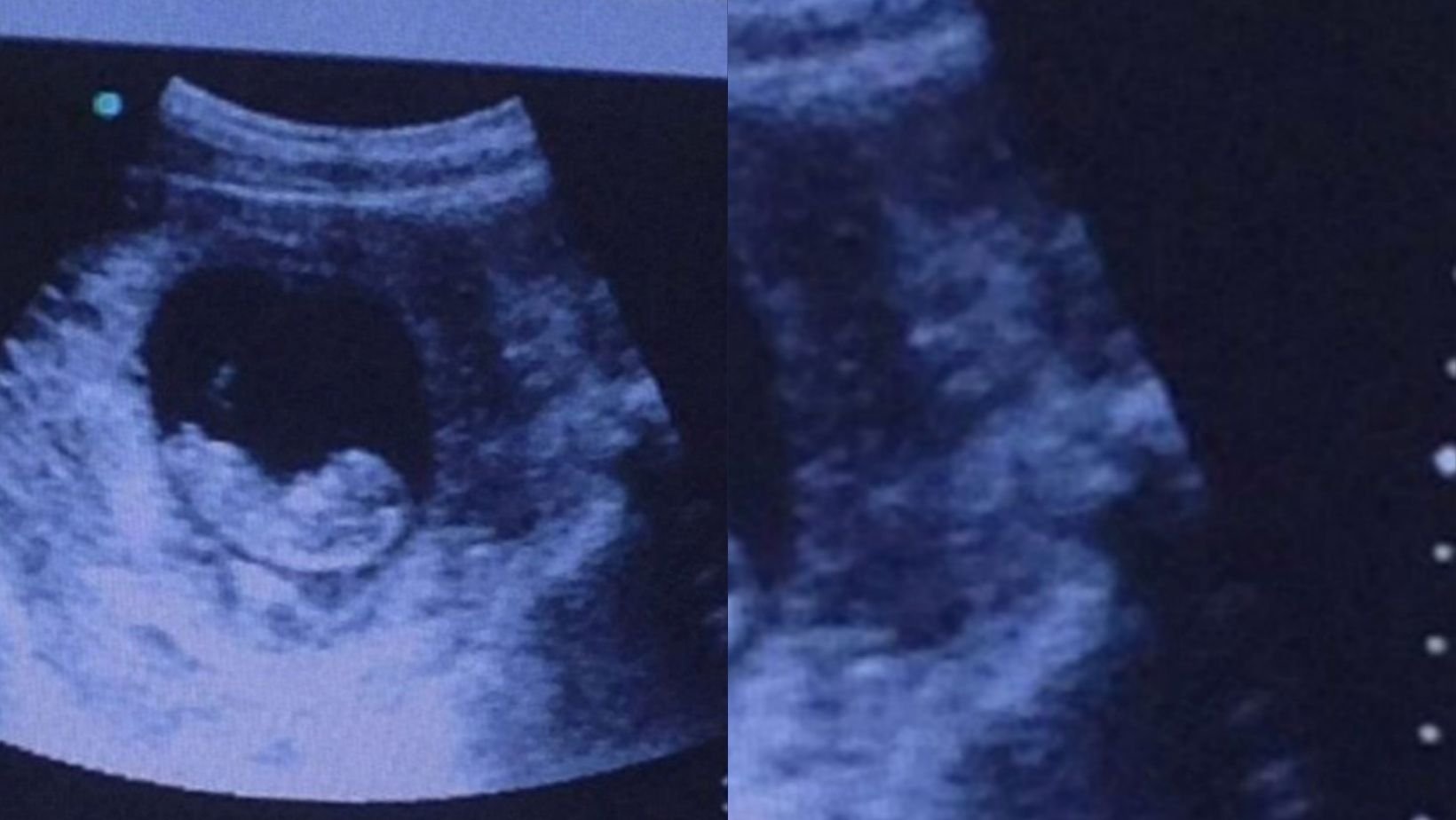 small joys thumbnail 3 1.jpg?resize=412,275 - Mom Was Horrified After Seeing A ‘Demon’ Watching Over Her Baby In Ultrasound Scan