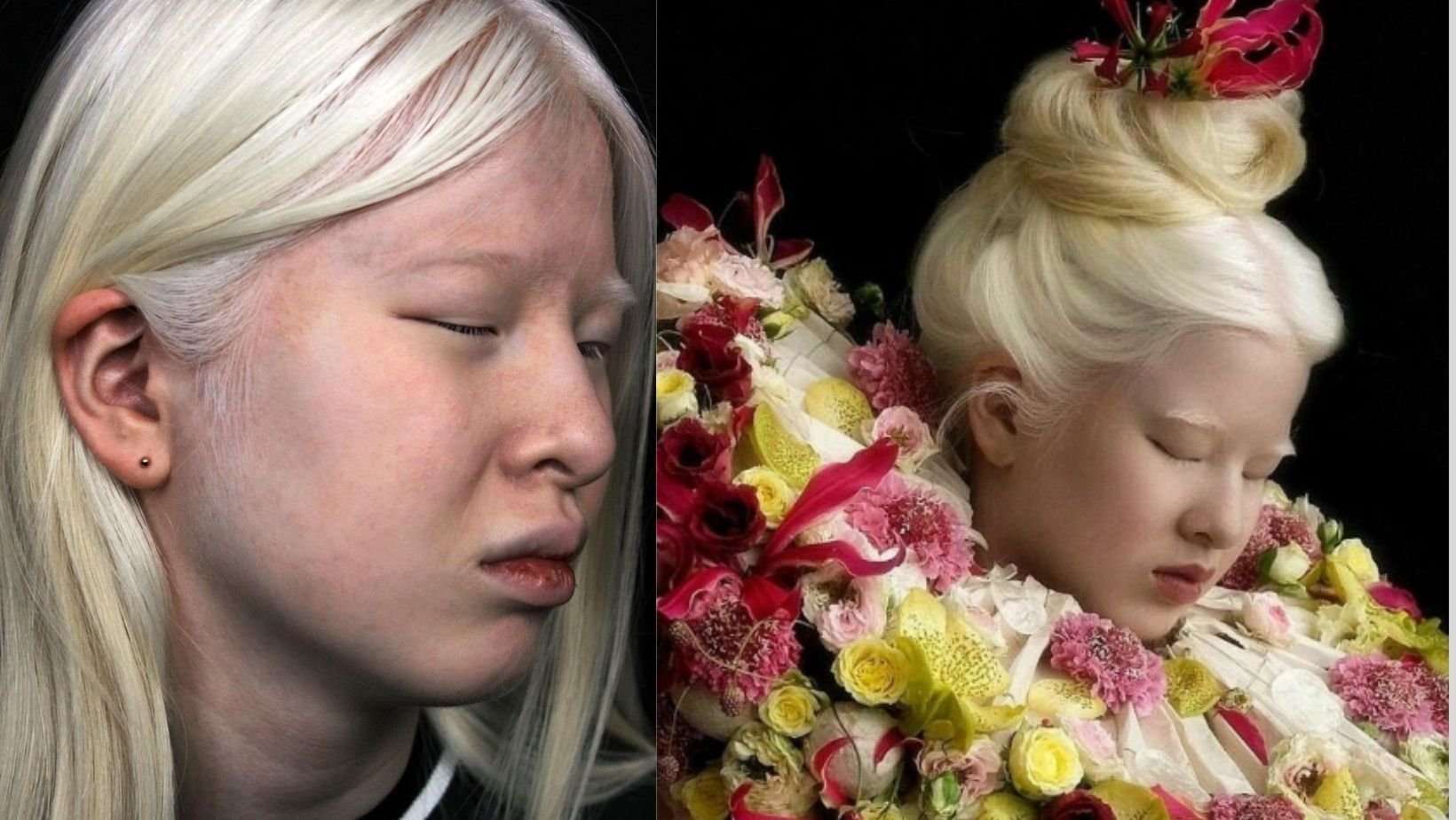 small joys thumbnail.jpg?resize=1200,630 - Albino Teenager Who Was Left Outside An Orphanage When She Was A Baby Is Now A Top Model