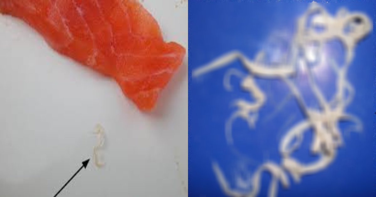 sushi.png?resize=412,275 - 毎週「サーモンの刺身」を食べた女性のお腹の中から7m寄生虫が出てきた