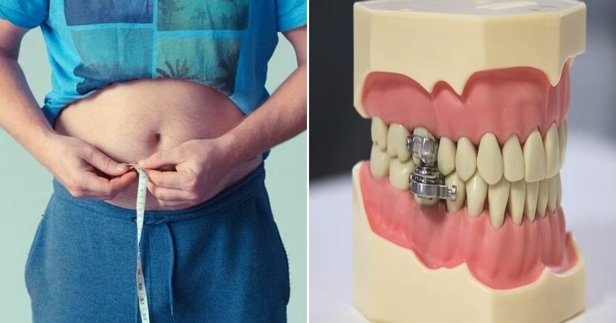 untitled design 37.jpg?resize=1200,630 - Doctors Invent Weight-Loss Device That Locks Your Teeth Together To Stop You From Snacking