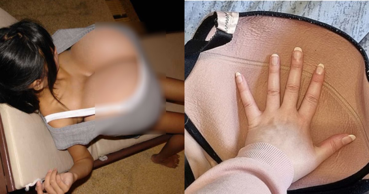 woman.png?resize=412,232 - 大きすぎる「Pカップの胸」乳房縮小術を受けに来た女性に対する病院の反応