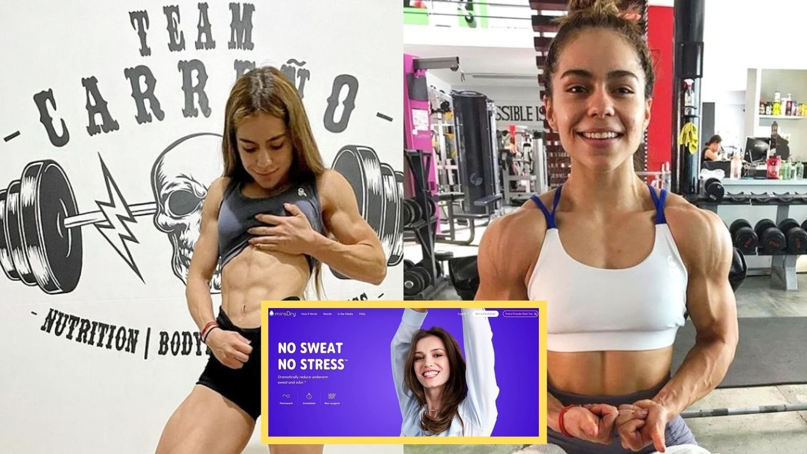 1 51.jpg?fit=1024%2C577&ssl=1&strip=all - Instagram Influencer Dies After An UNLICENSED Surgery To Reduce Underarm Sweating Has Gone Wrong