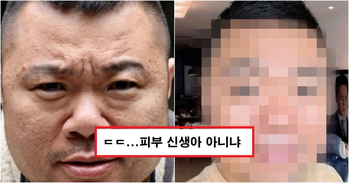 collage 272.png?fit=1024%2C538&ssl=1&strip=all - 피부 관리 3개월 받았더니 '송강' 닮았다는 정종철 근황 (사진)