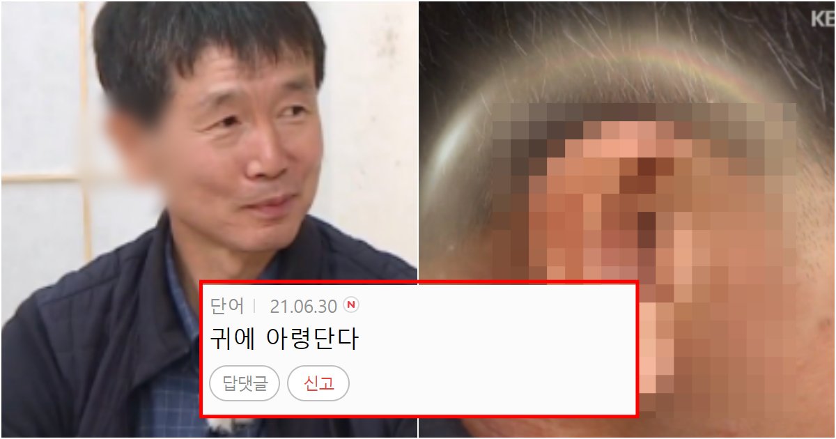 collage 51.png?resize=412,275 - 관상을 안믿던 사람도 믿게 된다는 로또 1등 당첨자의 귀 모양