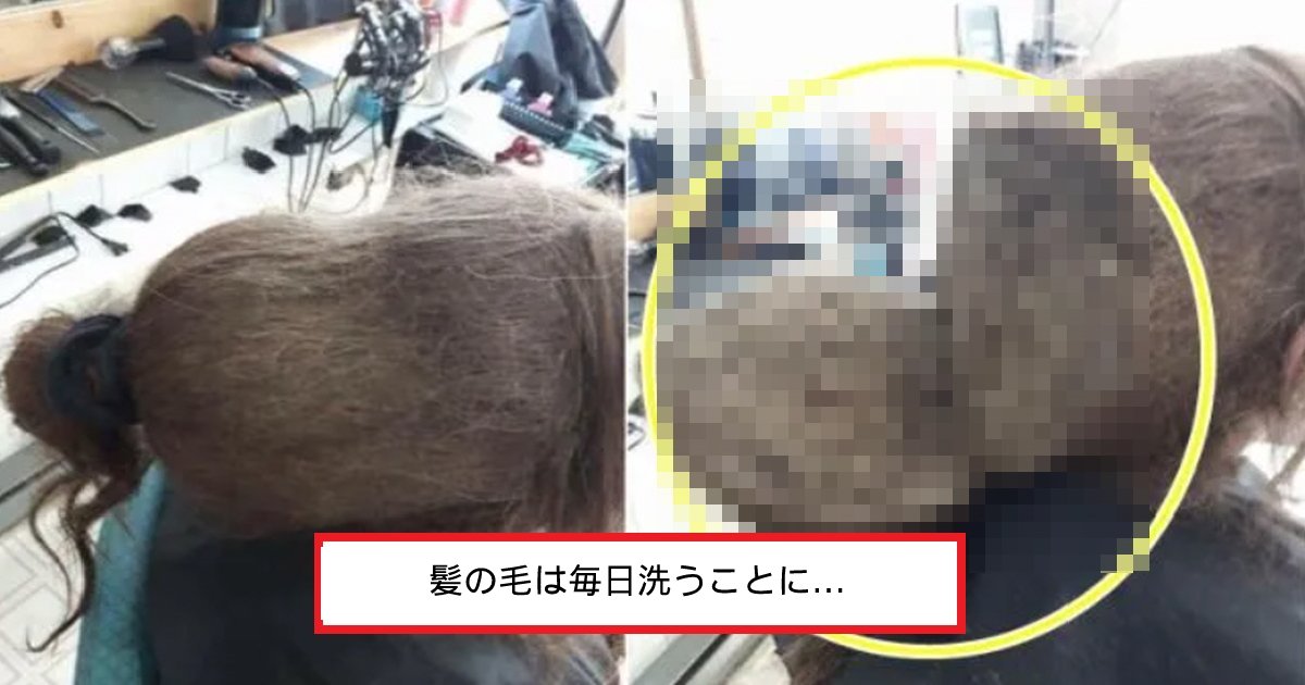 hair.png?resize=412,275 - 「なぜ人の髪の毛にカビが...？」3年間髪の毛を洗わなかった女性が最終的に散髪した姿とは⁉