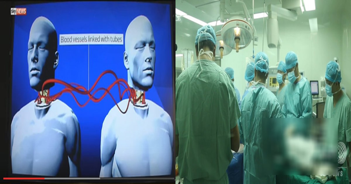 head.png?resize=1200,630 - 頭部を丸ごと移植する手術に成功した現代医学が手も足も出ない領域とは⁉