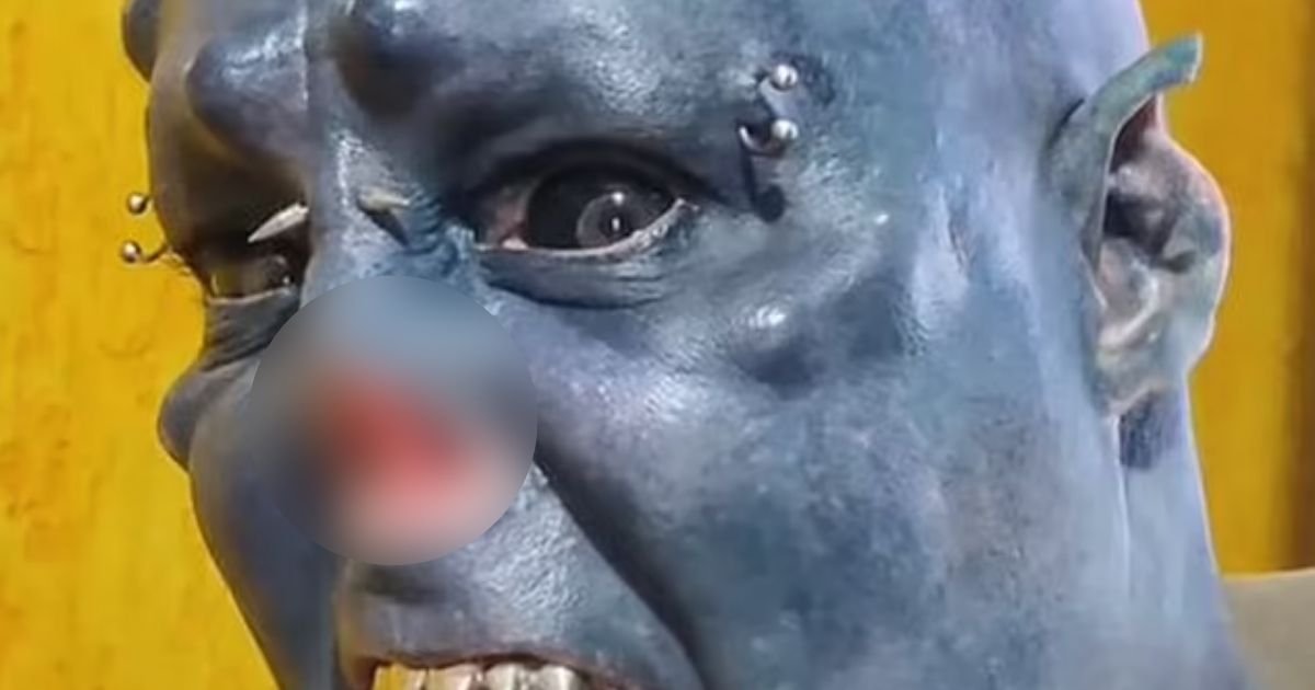 orc5.jpg?resize=1200,630 - Man Who Had His Nose Removed And Skin Tattooed Blue Has Shared A Photo Of Him Before Transformation