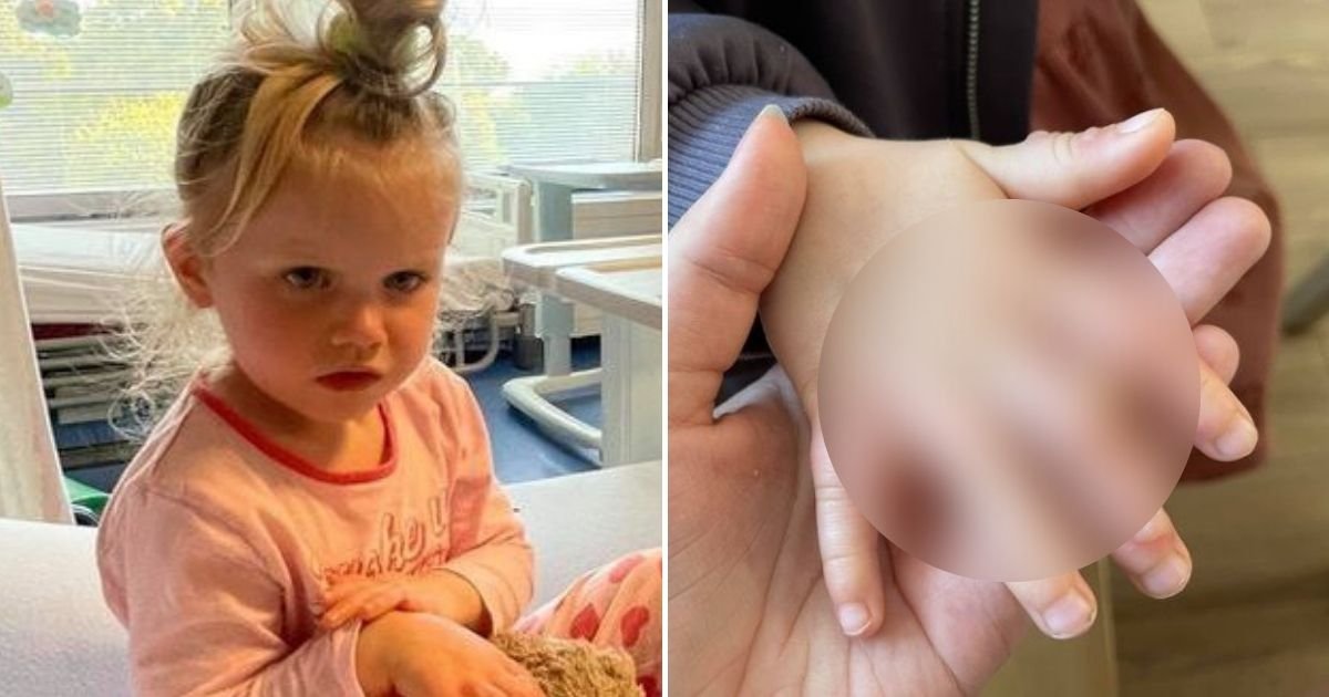 plant5.jpg?resize=1200,630 - Mother Issues Grave Warning After Daughter Suffers Agonizing Blisters From Touching A Plant On A Beach