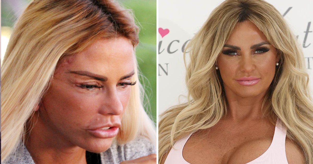 q5.jpg?resize=1200,630 - "You Must Think Of Your Kids Sometimes"- Katie Price's Ex SLAMS Her Plastic Surgery Journey