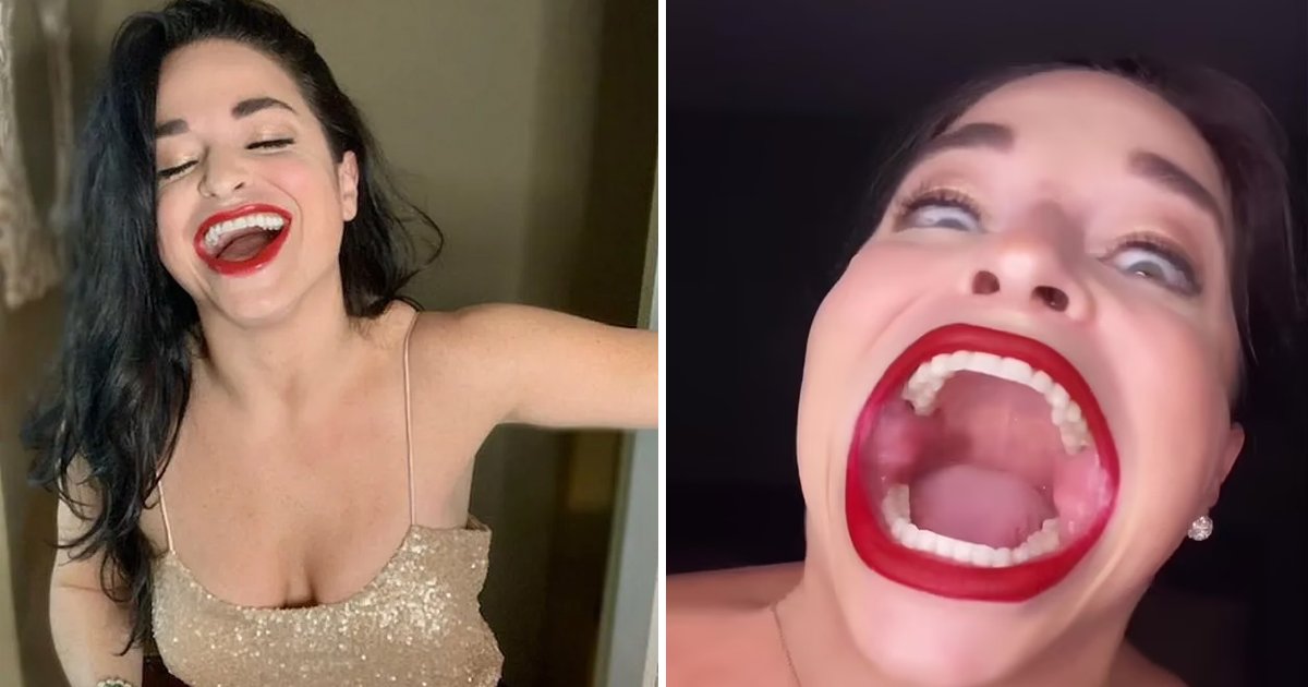 t1 75.jpg?fit=1024%2C538&ssl=1&strip=all - Woman With Incredible '2.56 Inch' Mouth Opening Becomes Guinness World Record Holder