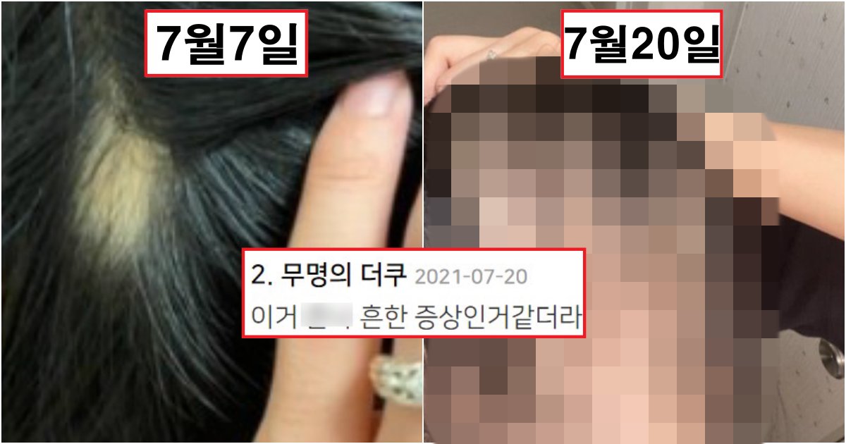 collage 243.png?resize=412,275 - "흔하게 나타나는 부작용이다"...모더나 백신 맞고 부작용 제대로 맞은 여자(사진)