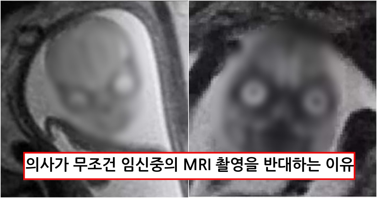 collage 273.png?resize=1200,630 - 임신했는데 MRI로 찍으면 이렇게 나와 무조건 산모 트라우마가 생겨 말린다는 아기 모습