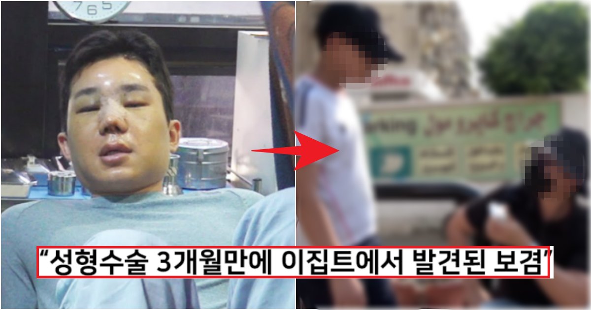 collage 276.png?resize=412,275 - "얼굴 공개 안 한다".. 성형수술 3개월 만에 이집트에서 모습을 공개한 유튜버 보겸