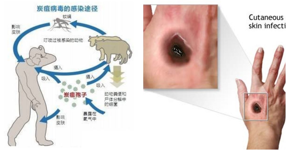 collage 411.png?resize=1200,630 - "치사율만 95%다.." 코로나를 이어서 또 중국에서 강력한 전염성 바이러스 발생했다