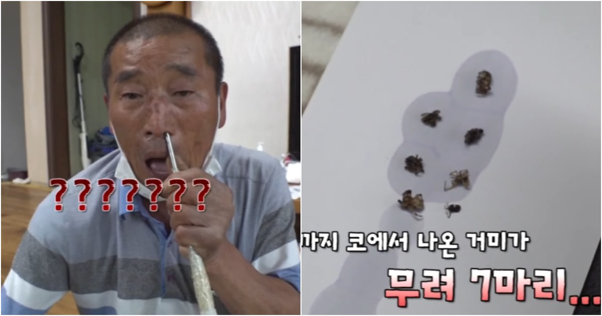 collage 753.png?resize=412,232 - 조회수 500만 찍어버렸던 머리에 거미가 들어갔다는 할아버지 사연