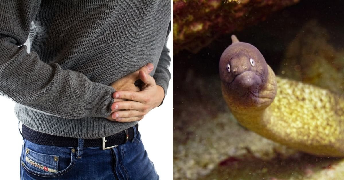 eel5.jpg?resize=412,275 - Man Inserted A Live EEL Into His Backside In A Desperate Attempt To Fix His Painful Stomach Problem