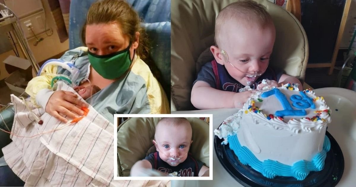 smalljoys 38.jpg?resize=1200,630 - World’s Most Premature Baby With 0% Of Survival At Birth DEFIES THE ODDS & Celebrates His 1st Birthday