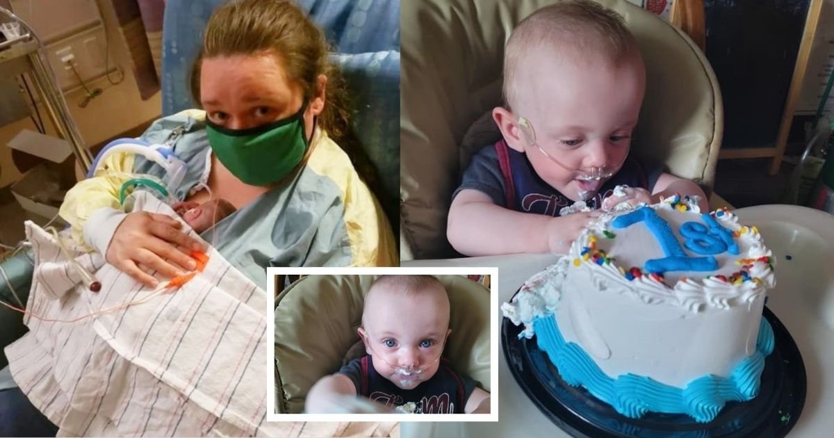 smalljoys 38.jpg?resize=412,232 - World’s Most Premature Baby With 0% Of Survival At Birth DEFIES THE ODDS & Celebrates His 1st Birthday