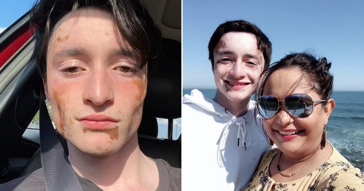 untitled design 11 1.jpg?resize=412,232 - Teenage Boy With Vitiligo Gets Accused Of 'Cultural Appropriation' Because Of His Unique Looks
