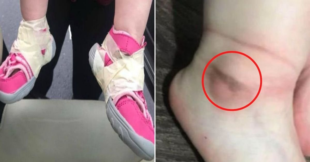 untitled design 17 2.jpg?resize=412,275 - Mother Furious After Daycare Worker TAPES Daughter's Shoes Onto The Child’s Feet