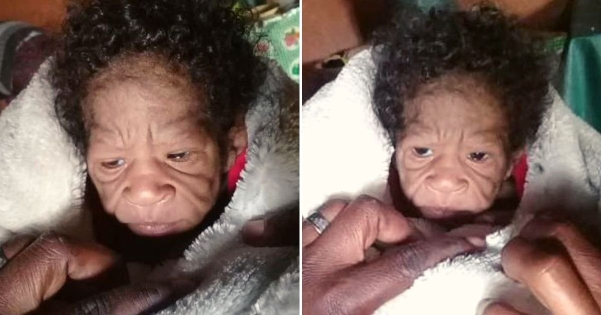 baby4.jpg?resize=1200,630 - New Mom Gives Birth To Baby Girl Who 'Looks Older Than Her' After Her Daughter Was Born With An Extremely Rare Condition