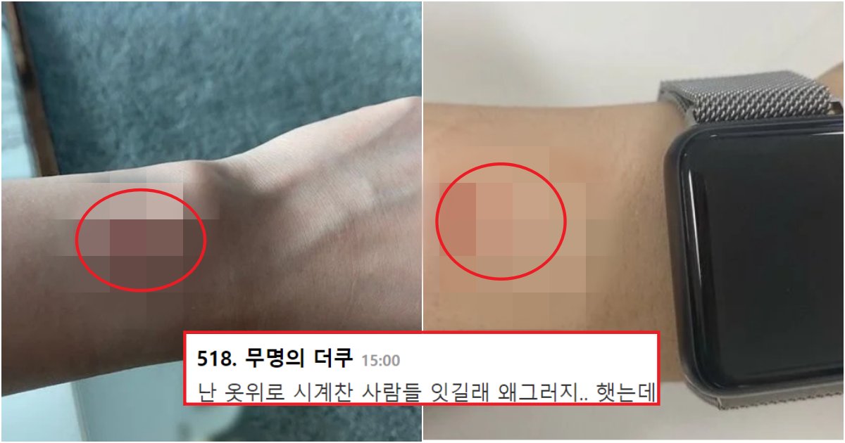 collage 352.png?resize=412,275 - 현재 애플워치 착용 하는 사람들에게, 유행 중이라는 이 '증상' (+사진)