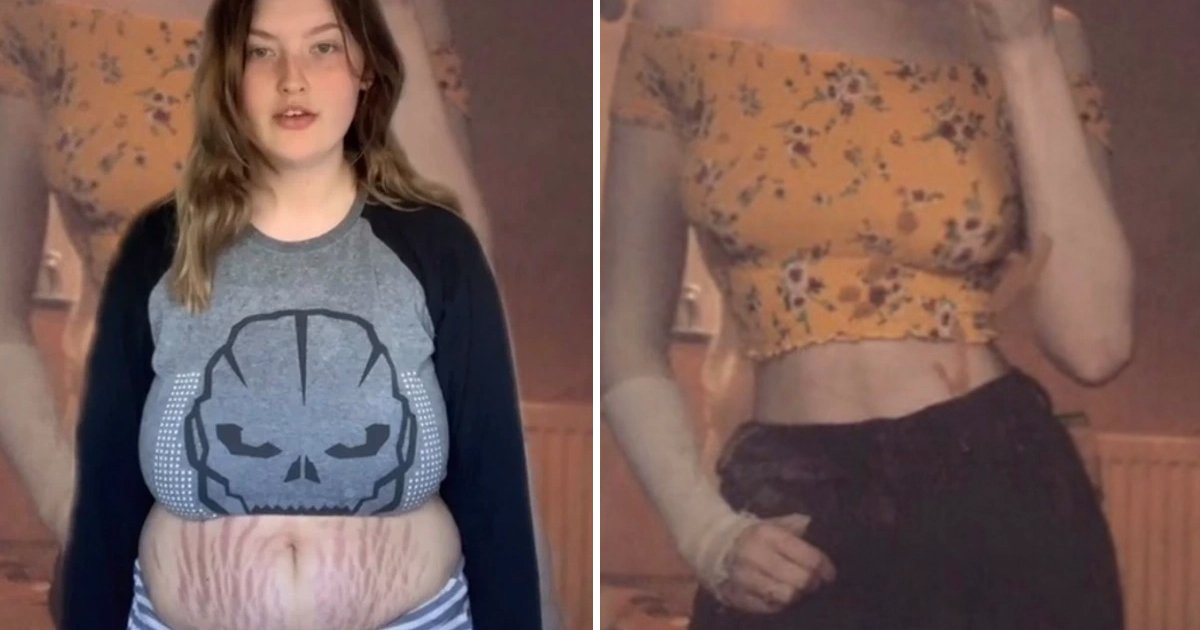 t3 100.jpg?resize=1200,630 - "I Think My Stretch Marks Are Beautiful"- Teen Mum Goes On Mission To Normalize Her Post-Pregnancy Body After Being Trolled Online