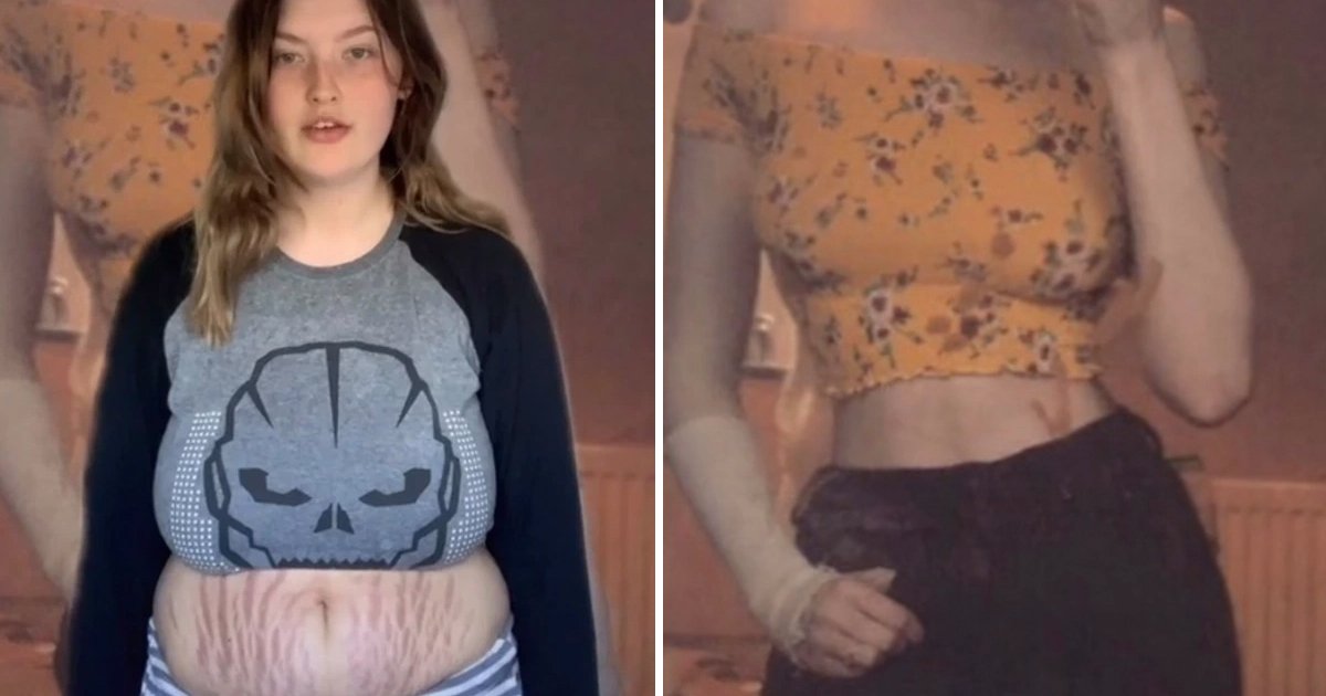 t3 100.jpg?resize=412,232 - "I Think My Stretch Marks Are Beautiful"- Teen Mum Goes On Mission To Normalize Her Post-Pregnancy Body After Being Trolled Online